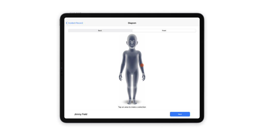 A screenshot of the Incident Report (essential for childcare documentation) in Playground, showing a model of child's body where educators can indicate injuries